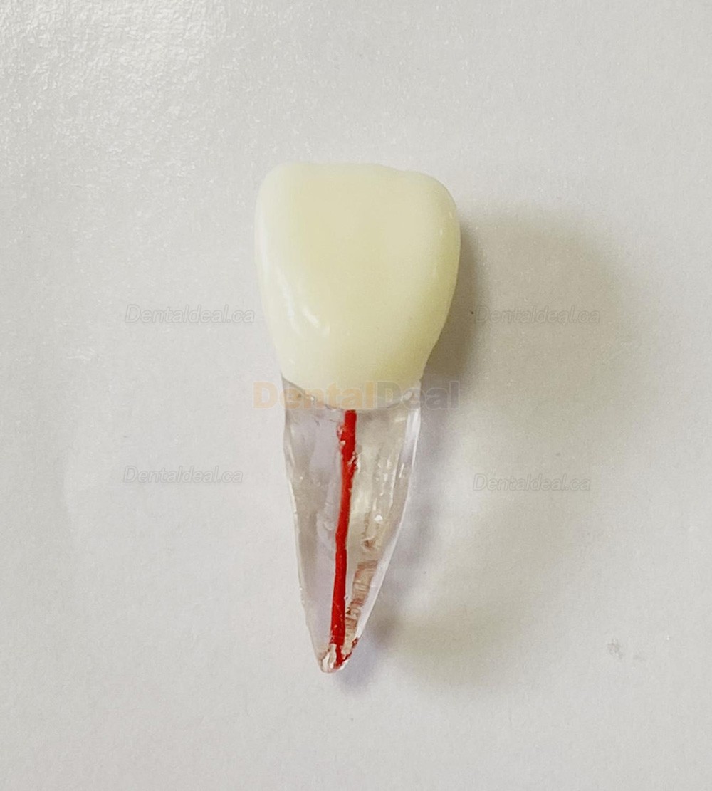Dental Teeth Practice Model Endo File Molar Upper Lower Tooth Premolar Root 2/3-Rooted Canal